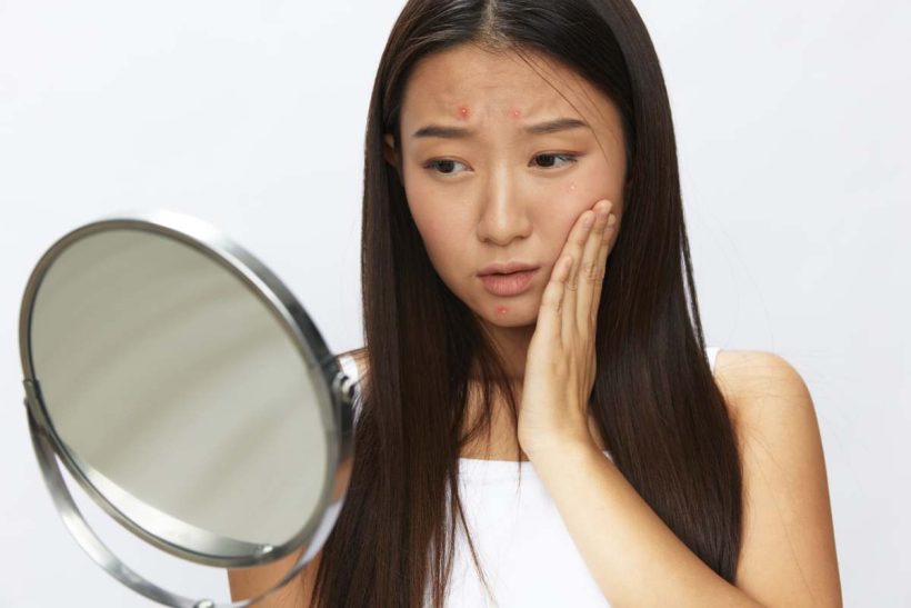 Asian woman with mirror in hand facial skin problems, acne and inflammation, red rash and allergies, chicken pox, sadness from rashes. Facial skin care concept for diseases and nerves. High quality photo